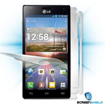 ScreenShield fólie na displej + carbon skin (stříbrná) pro LG E610 Optimus L5